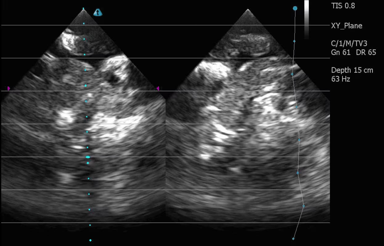 Adult Heart for X-Ray CT, US, MRI HT-A01 / HT-A02 image 22