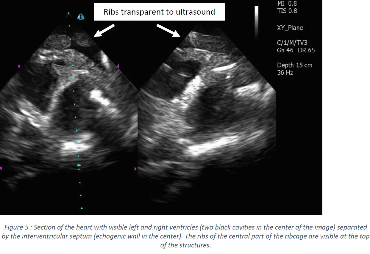 Adult Heart Phantom for X-Ray CT, US, MRI