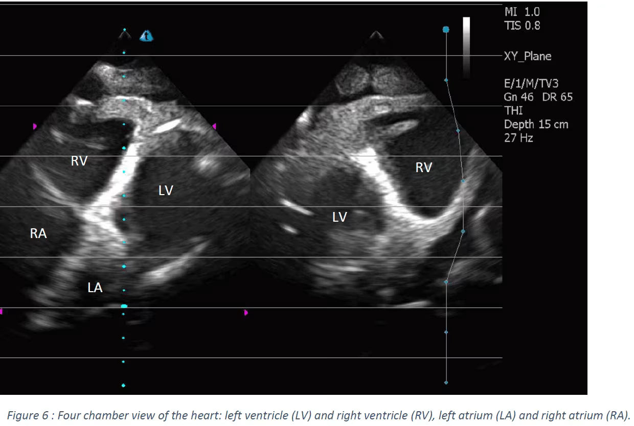 Adult Heart for X-Ray CT, US, MRI HT-A01 / HT-A02 image 24