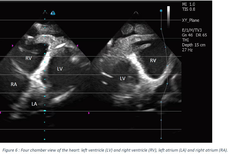 Adult Heart Phantom for X-Ray CT, US, MRI