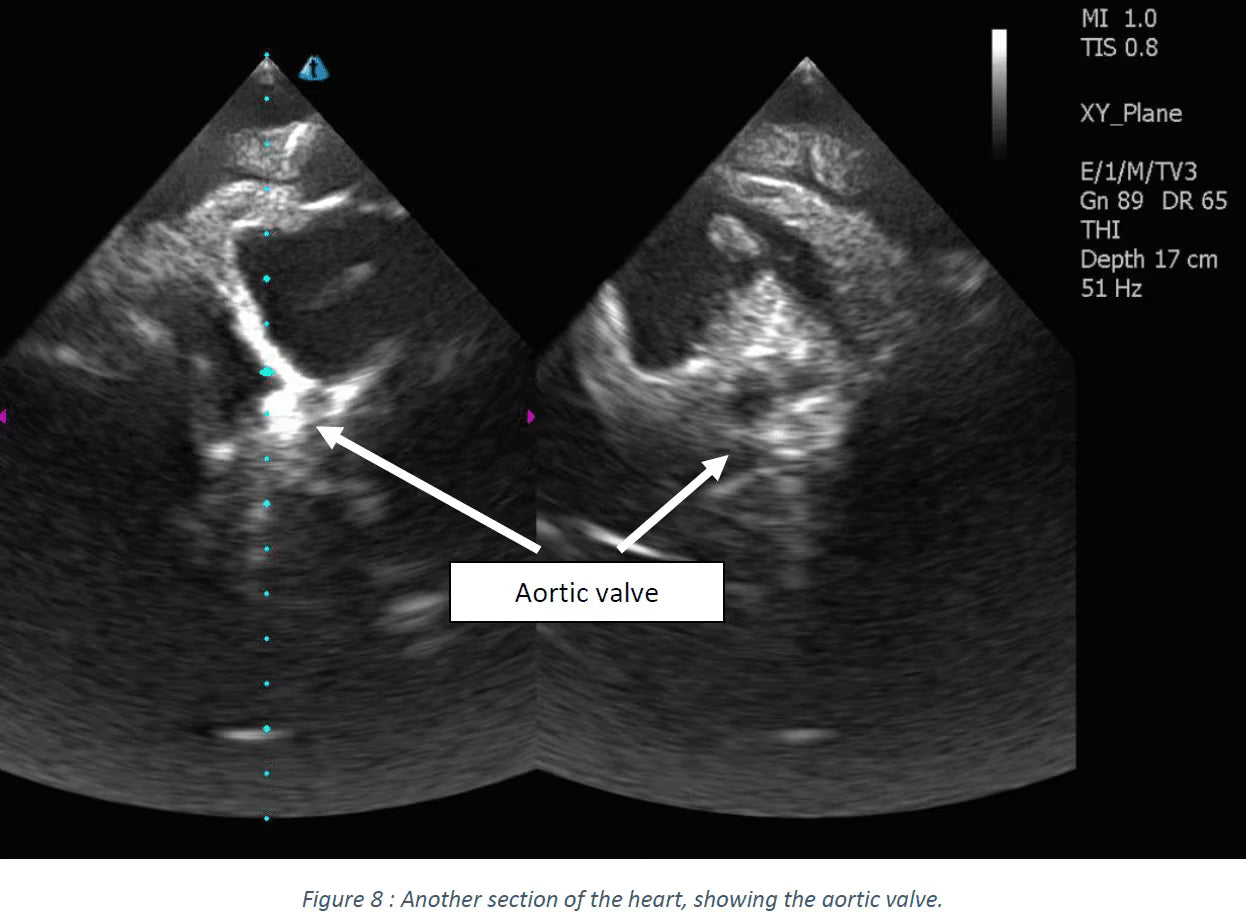 Adult Heart for X-Ray CT, US, MRI HT-A01 / HT-A02 image 26