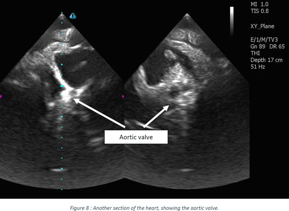 Adult Heart Phantom for X-Ray CT, US, MRI