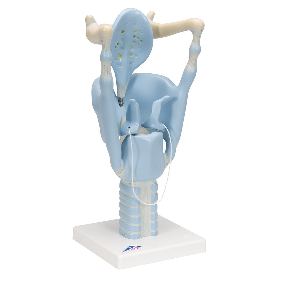 Functional Larynx Model (3 times life size)