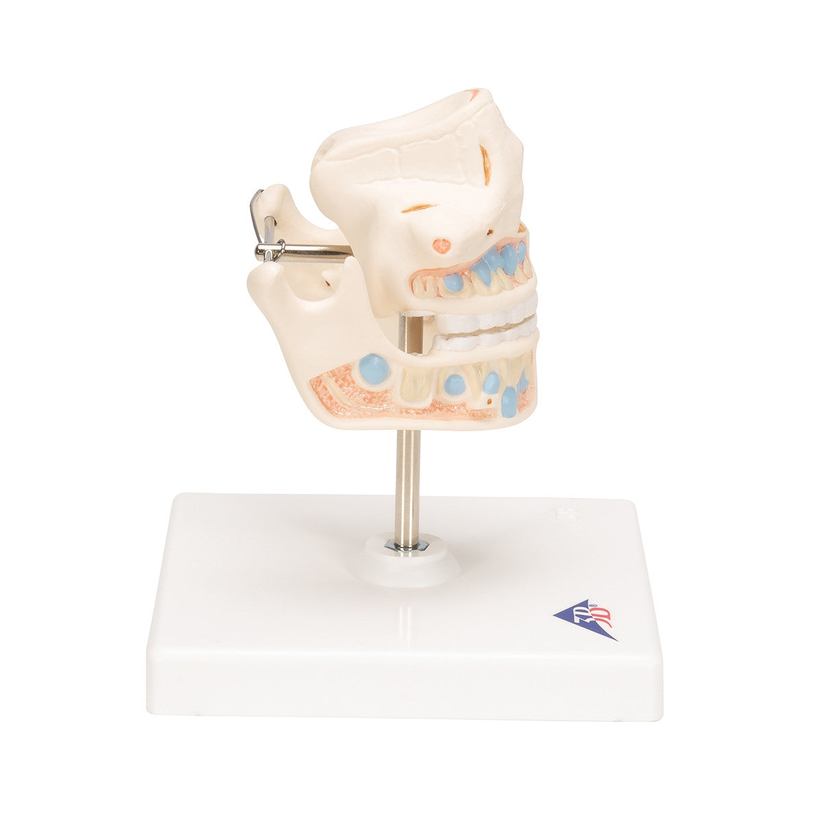 Milk Dentures Model