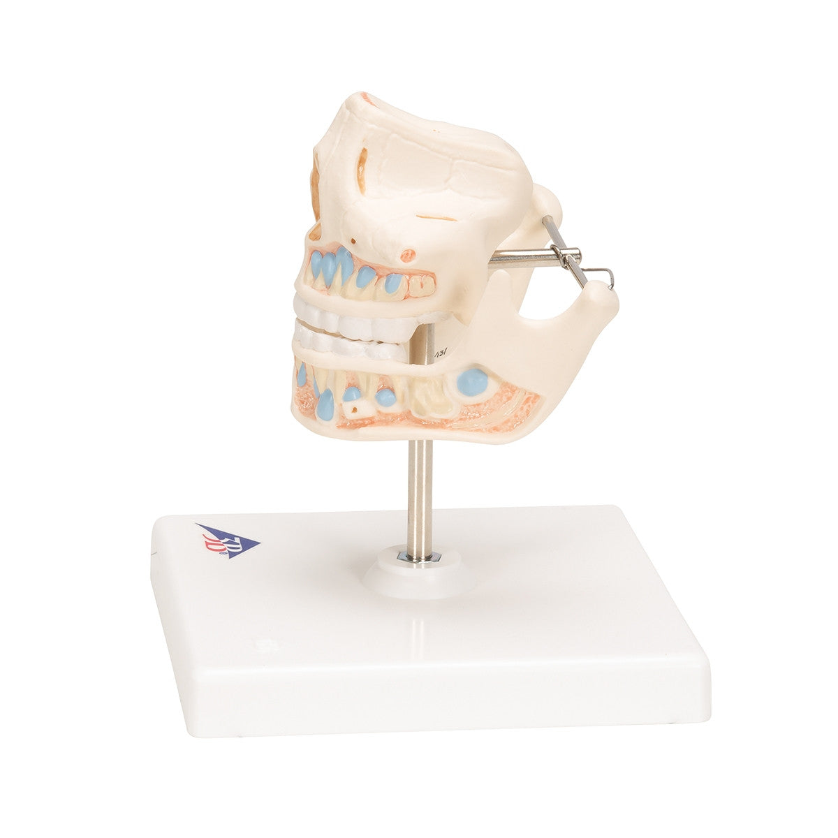 Milk Dentures Model