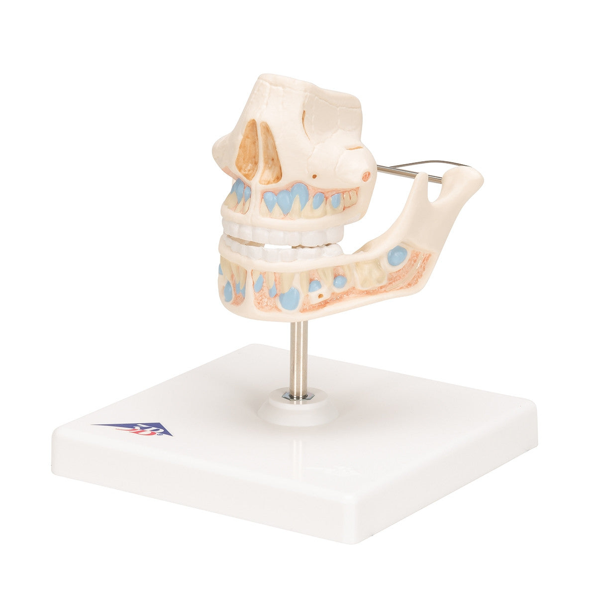 Milk Dentures Model