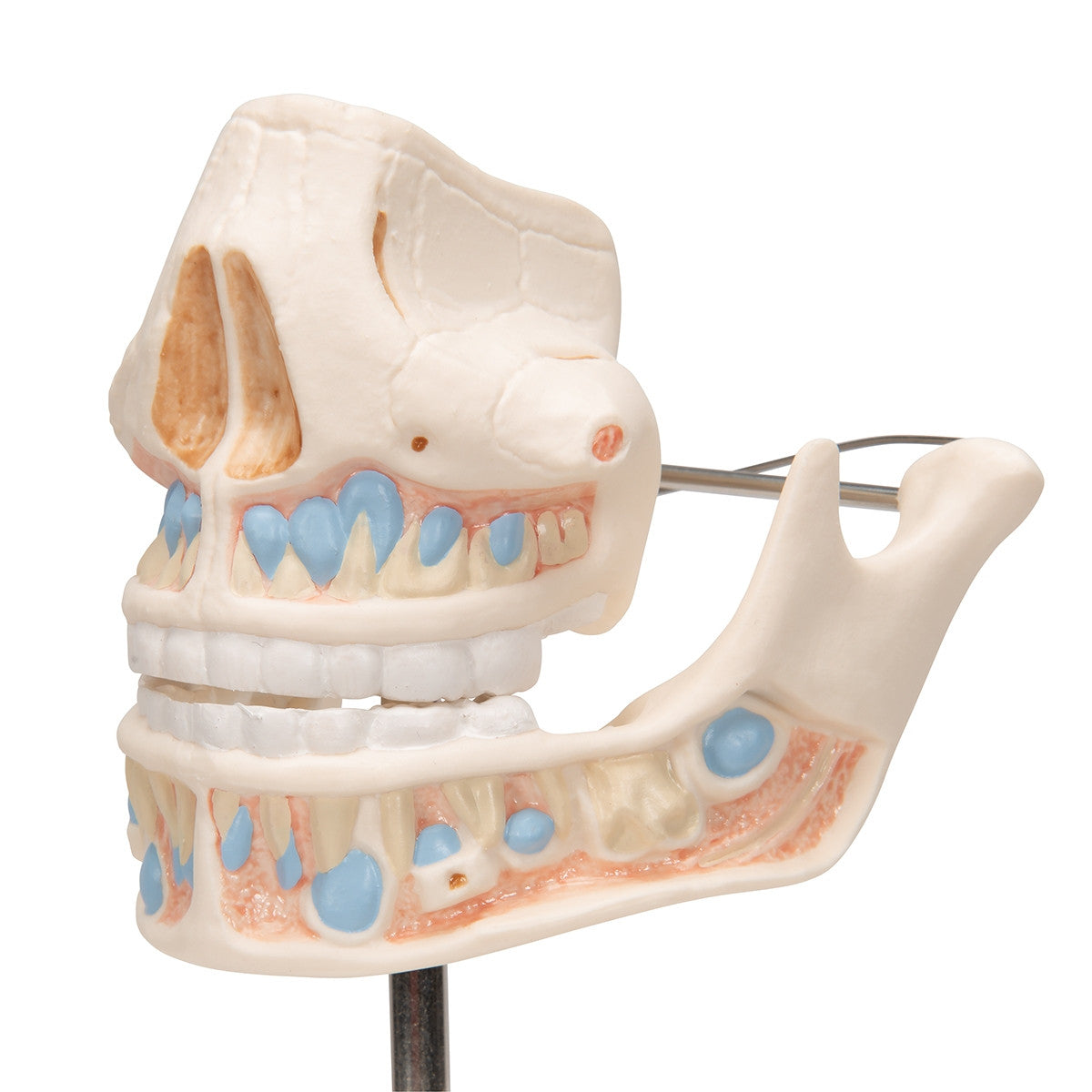 Milk Dentures Model
