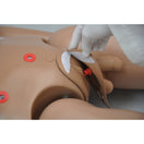 Switch Practice Various Stoma Care Procedures 2 image
