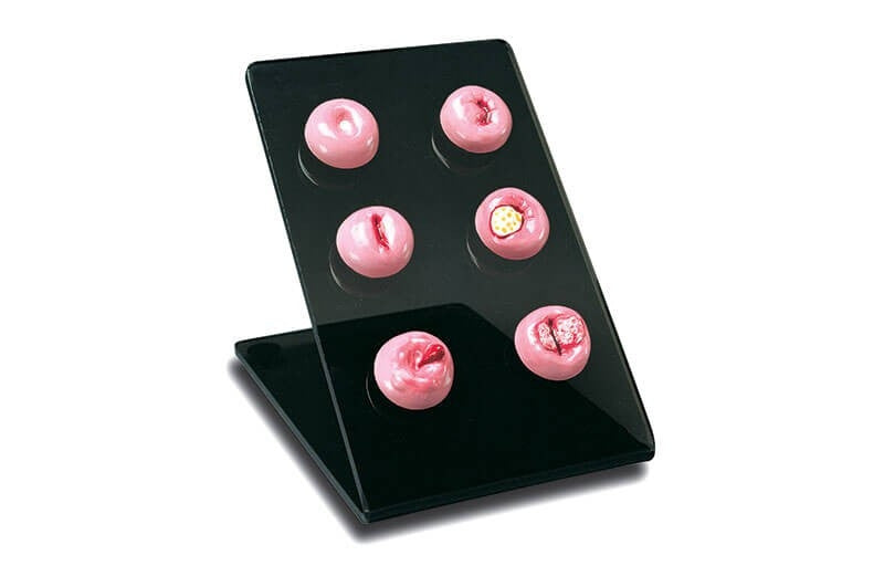 Cervical Replicas Model