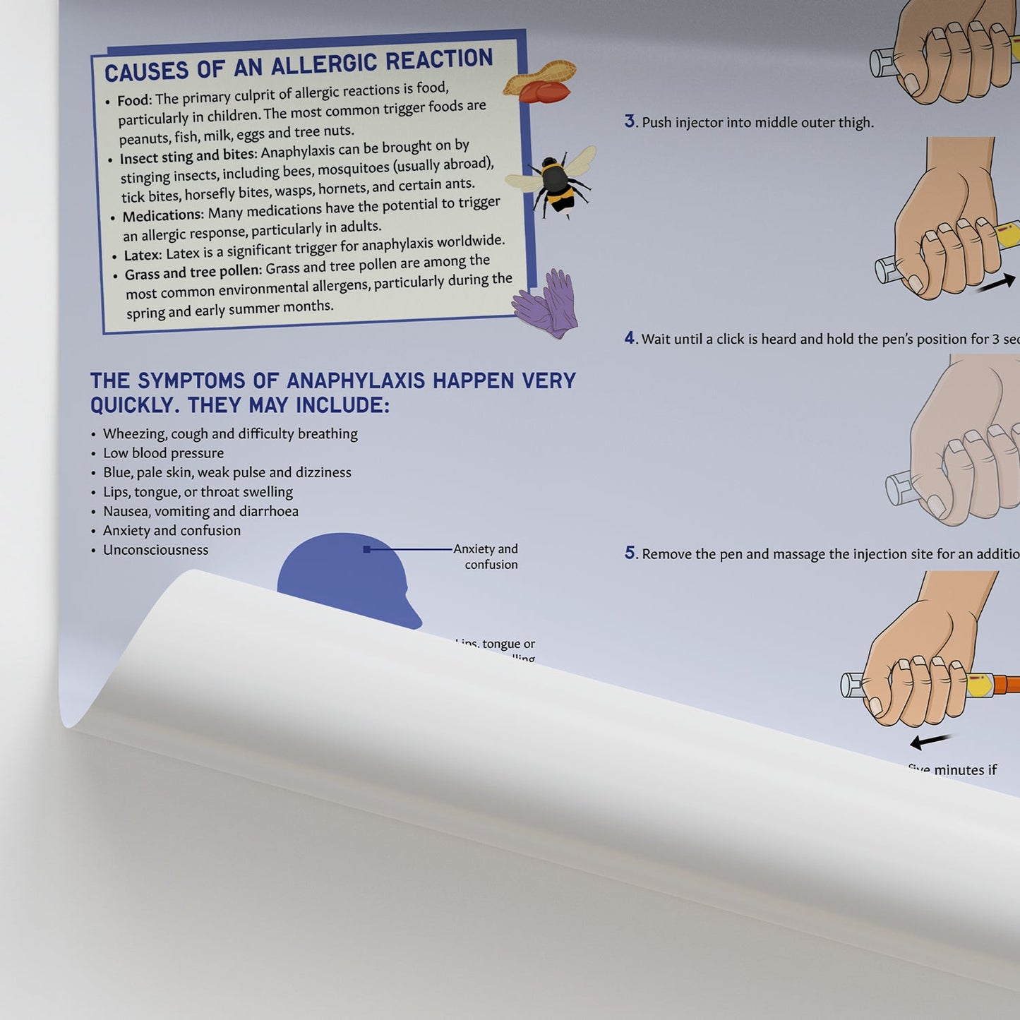 What to Do In Case of An Allergic Reaction Chart / Poster - Part of Collection