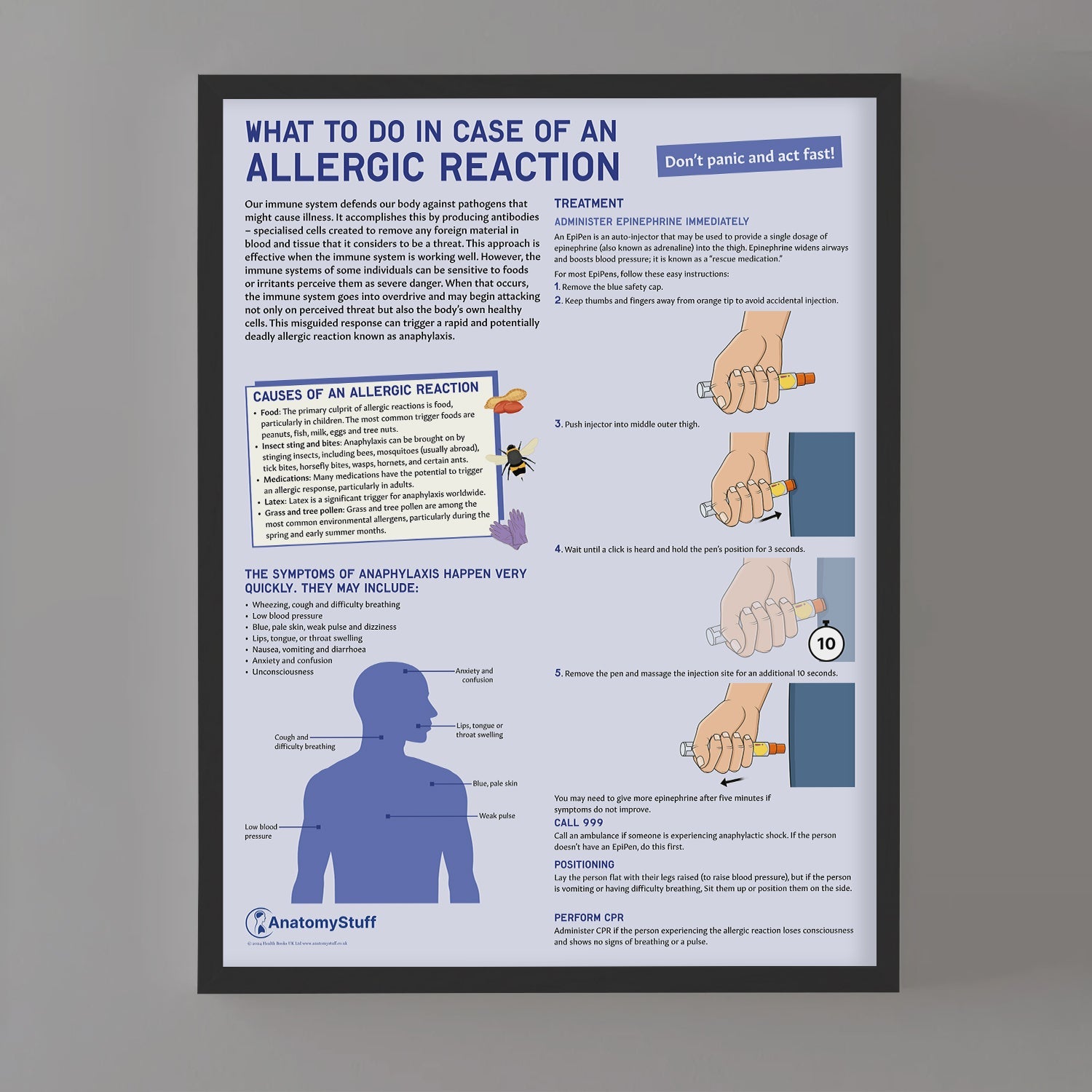 What to Do In Case of An Allergic Reaction Chart / Poster - Part of Collection