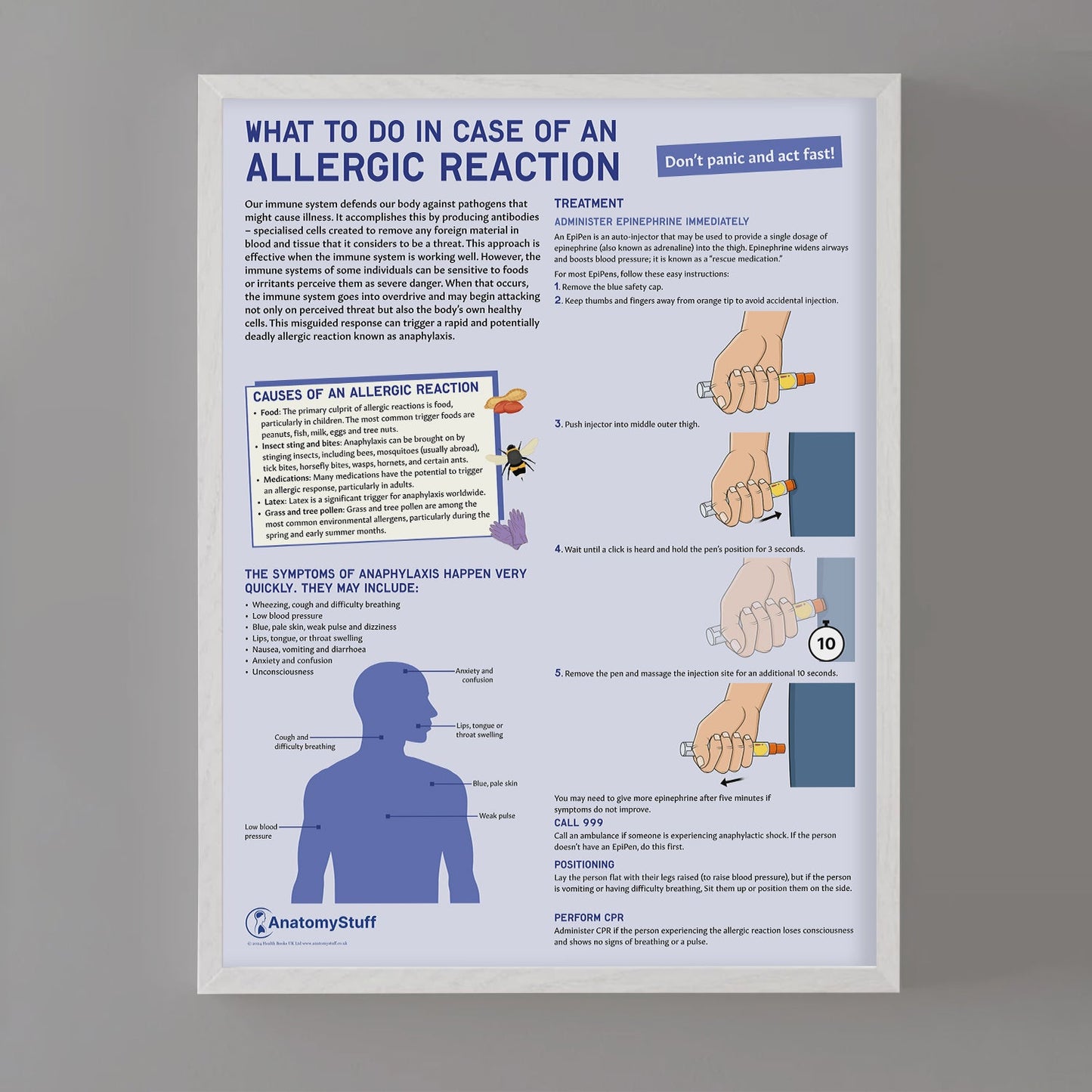 What to Do In Case of An Allergic Reaction Chart / Poster - Part of Collection