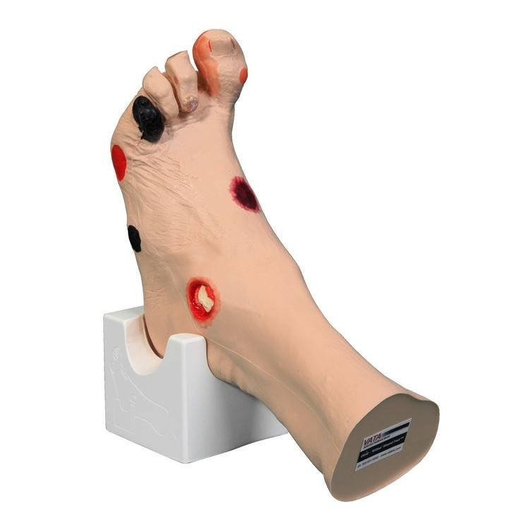 Wilma Wound Foot Trainer