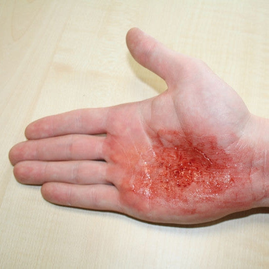 Lifelike wound with textile imprint
