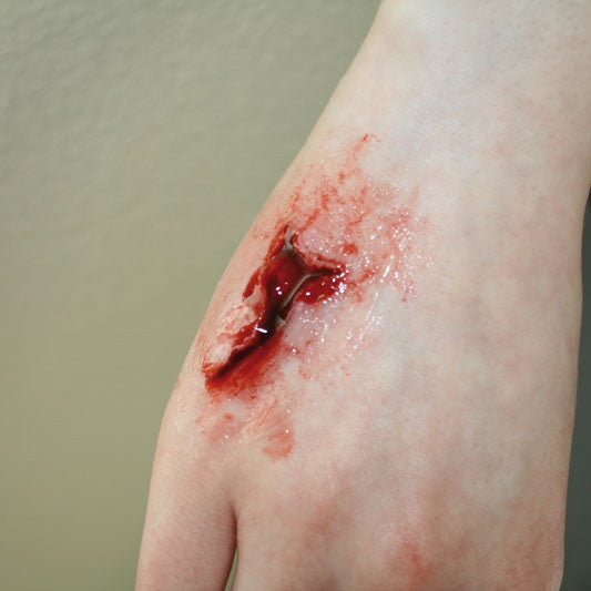Wound creation kit consists of 4 moulds